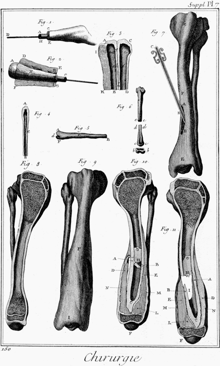 tibia incisione linsostenibile02 Linsostenibile leggerezza dellosso